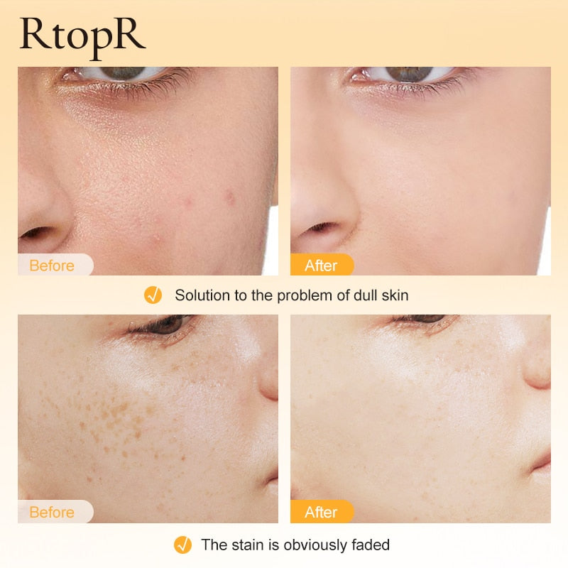 Arbutin Spot Lightening Serum / Vitamin C Facial Essence / Whitening and Brightening Face Skin Care for Women and Men - inneroasisco