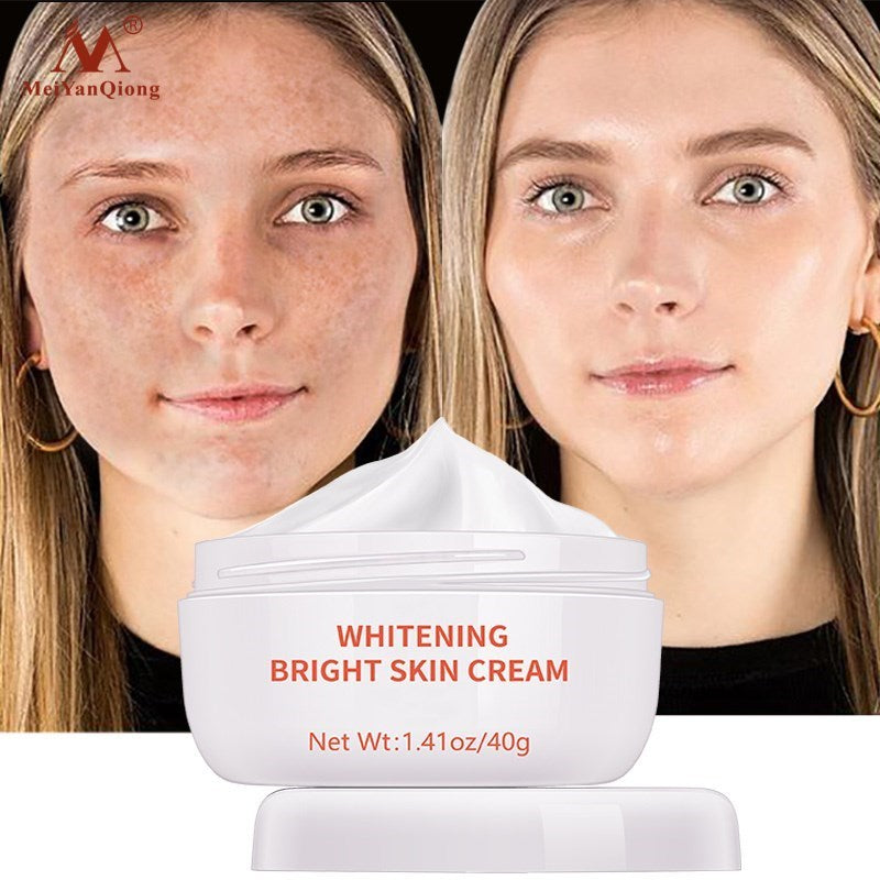 Powerful Whitening Freckle Cream & Acne Spots Melanin Dark Spots Remover - inneroasisco