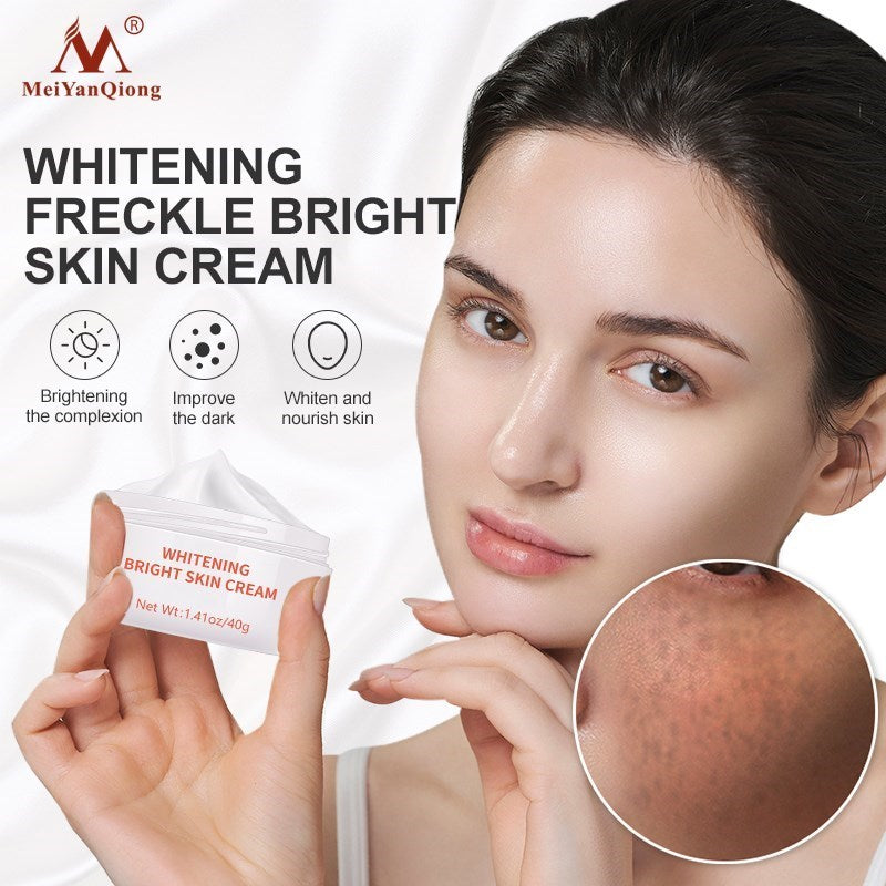 Powerful Whitening Freckle Cream & Acne Spots Melanin Dark Spots Remover - inneroasisco