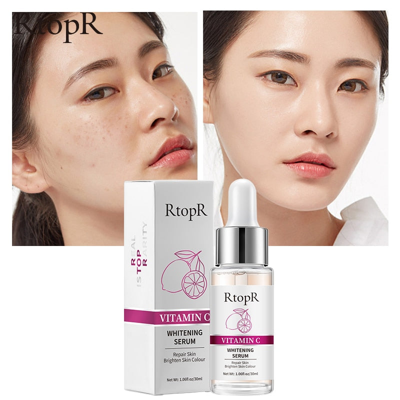 Arbutin Spot Lightening Serum / Vitamin C Facial Essence / Whitening and Brightening Face Skin Care for Women and Men - inneroasisco
